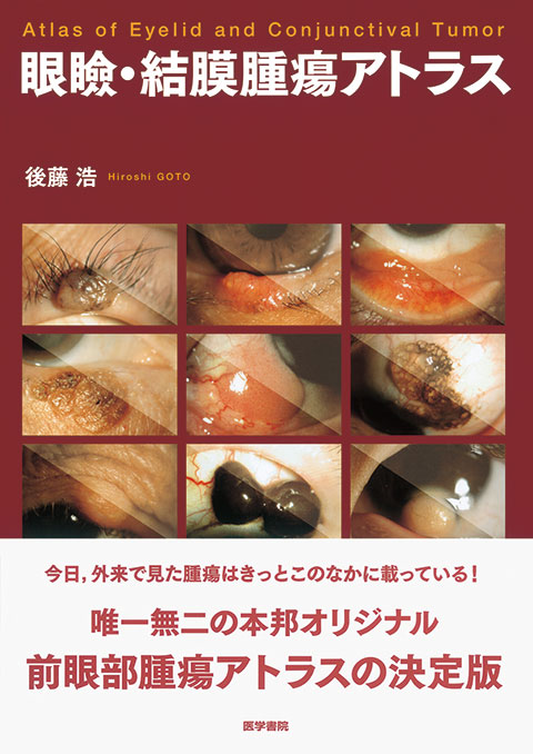 今日の眼疾患治療指針 第4版 | 書籍詳細 | 書籍 | 医学書院