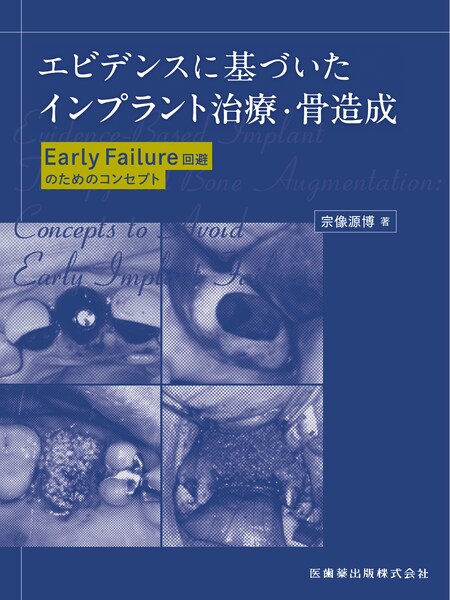 よくわかる口腔インプラント学 第4版／医歯薬出版株式会社