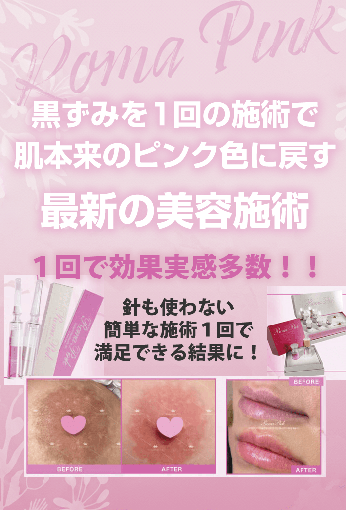 ローマピンク