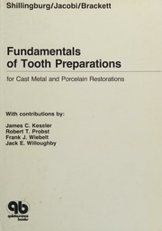 Fundamentals of tooth preparations for cast metal and porcelain