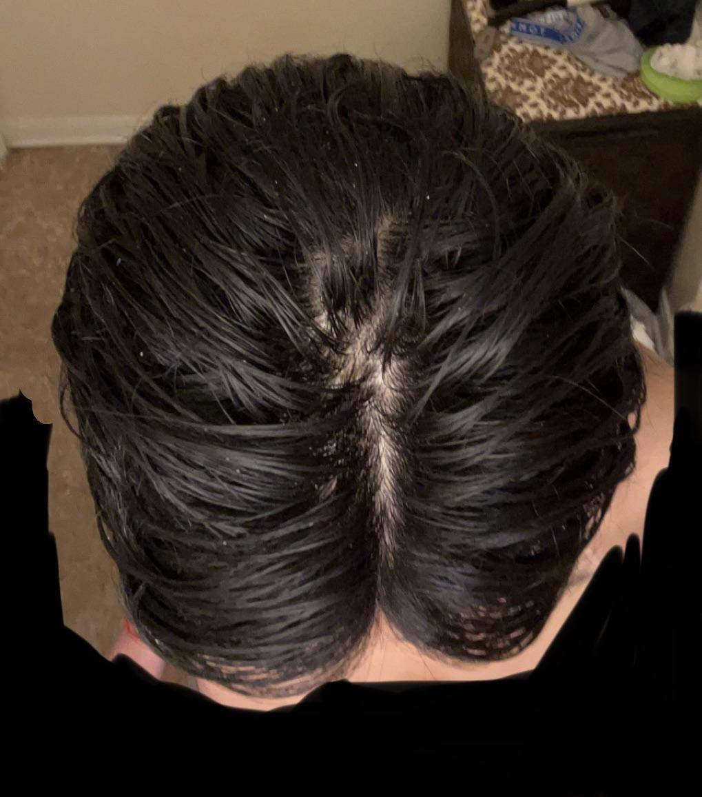 Don't want to buzz my hair again : r/Haircare