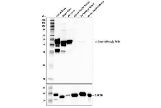 CD31 Antibody (PECAM-1) (D8V9E) XP® Rabbit mAb | Cell Signaling